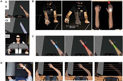 Altered bodily perceptions in chronic neuropathic pain conditions and implications for treatment using immersive virtual reality